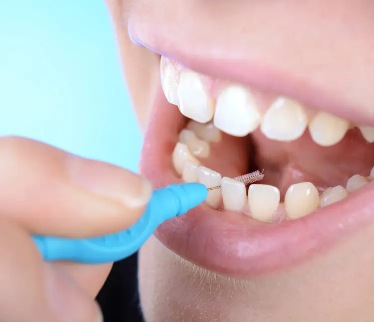 „Nahaufnahme eines Mundes, in dem eine Person mit einer blauen Interdentalbürste die Zahnzwischenräume reinigt