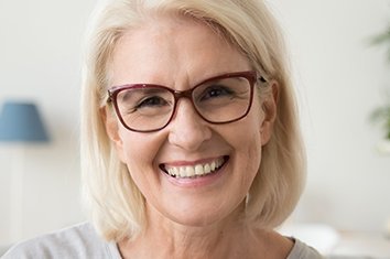 Zahnimplantate Patientin Frau AllDent