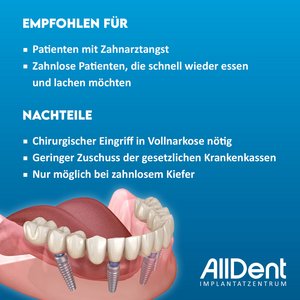 FDZ Infografik Nachteile
